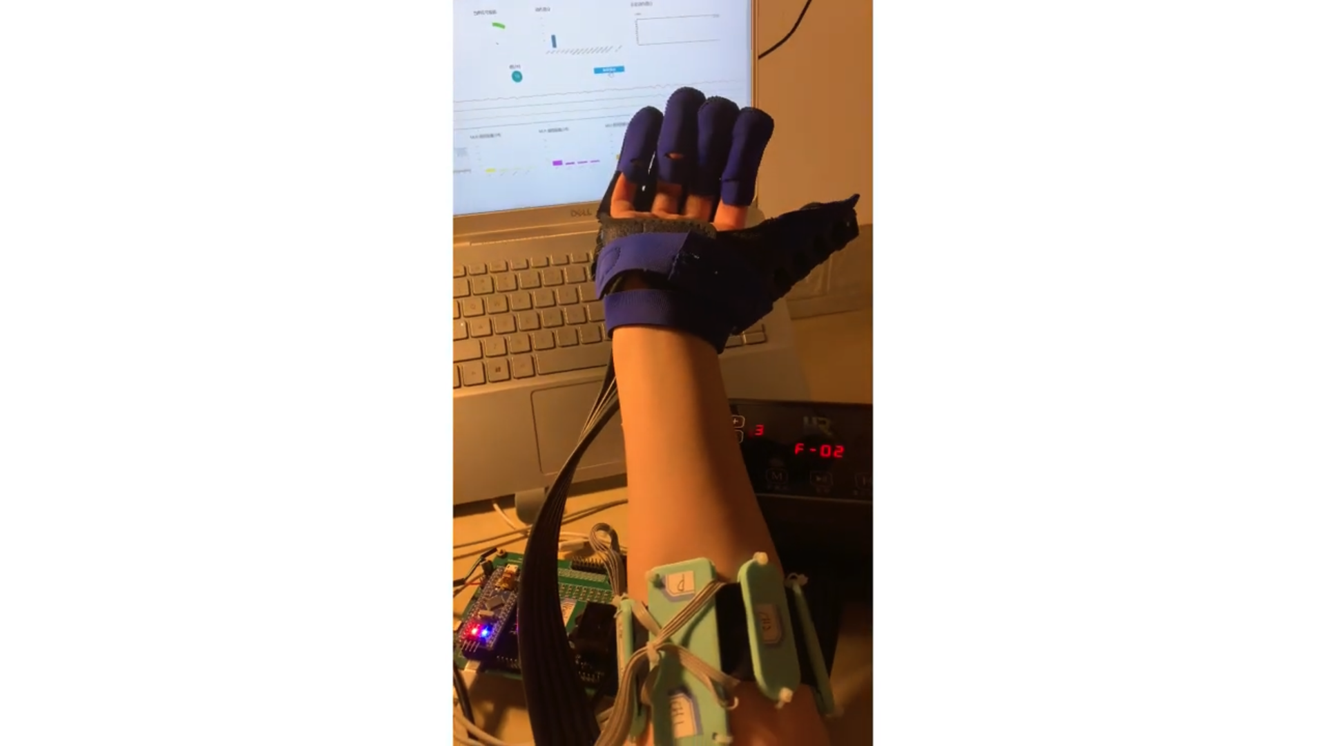 EMG system based on Action Recognition
